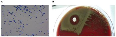 Antibiotic resistance of Streptococcus pneumoniae in Vietnamese children with severe pneumonia: a cross-sectional study